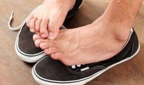 Itching as the cause of fungi