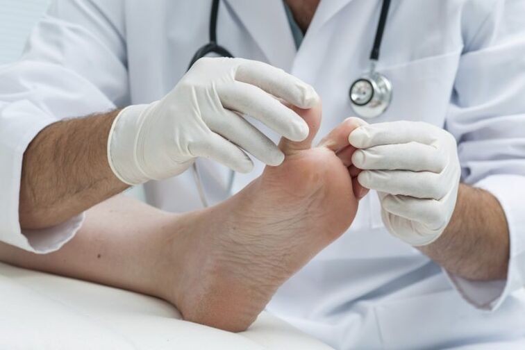 Examination of the doctor by the presence of mycosis